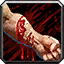 Arterial Bleed